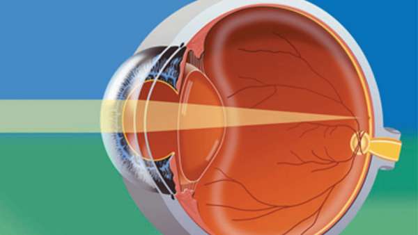 Anatomy of the eye showing light passing through the lens